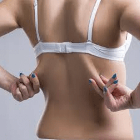 back fat